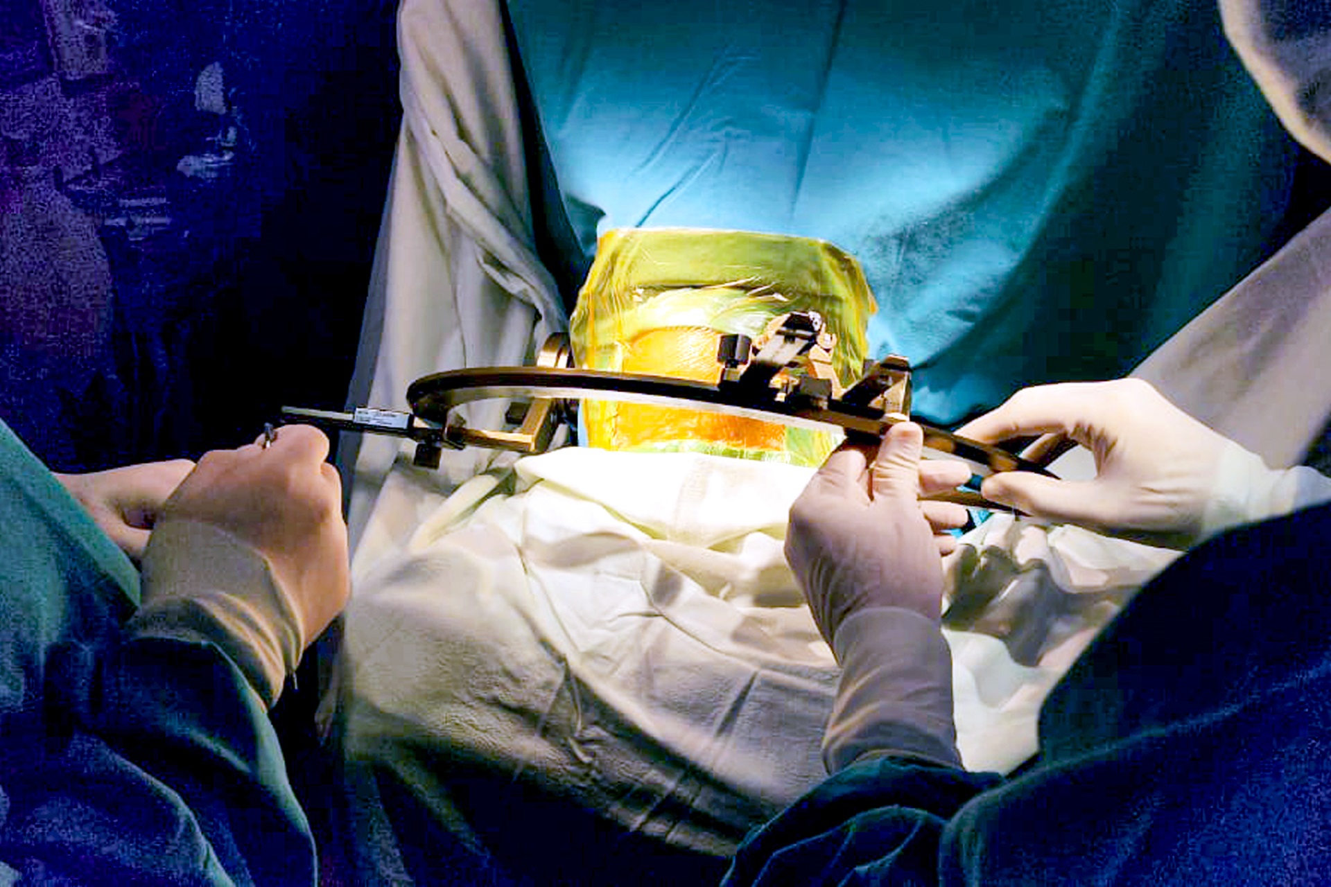 2024 08 10 salud cirugia parkinson 3